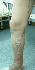 Symptom Photo 1