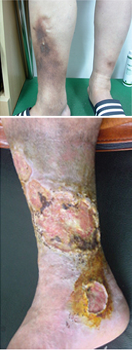 Symptom Photo 2